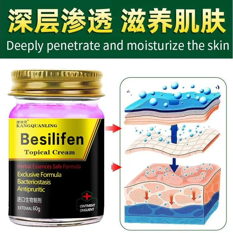 美国配方止痒膏外用皮肤痒湿痒干痒全身可用四季通用大腿内侧止痒