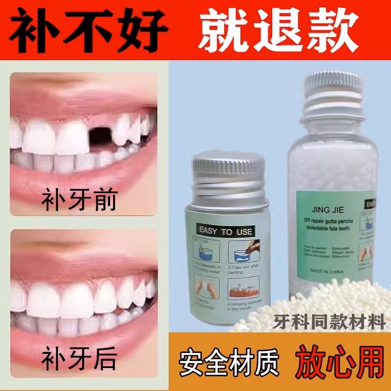 全口补牙套装颗粒缺牙 自己动手牙洞充填剂透明通用 不会用找客服