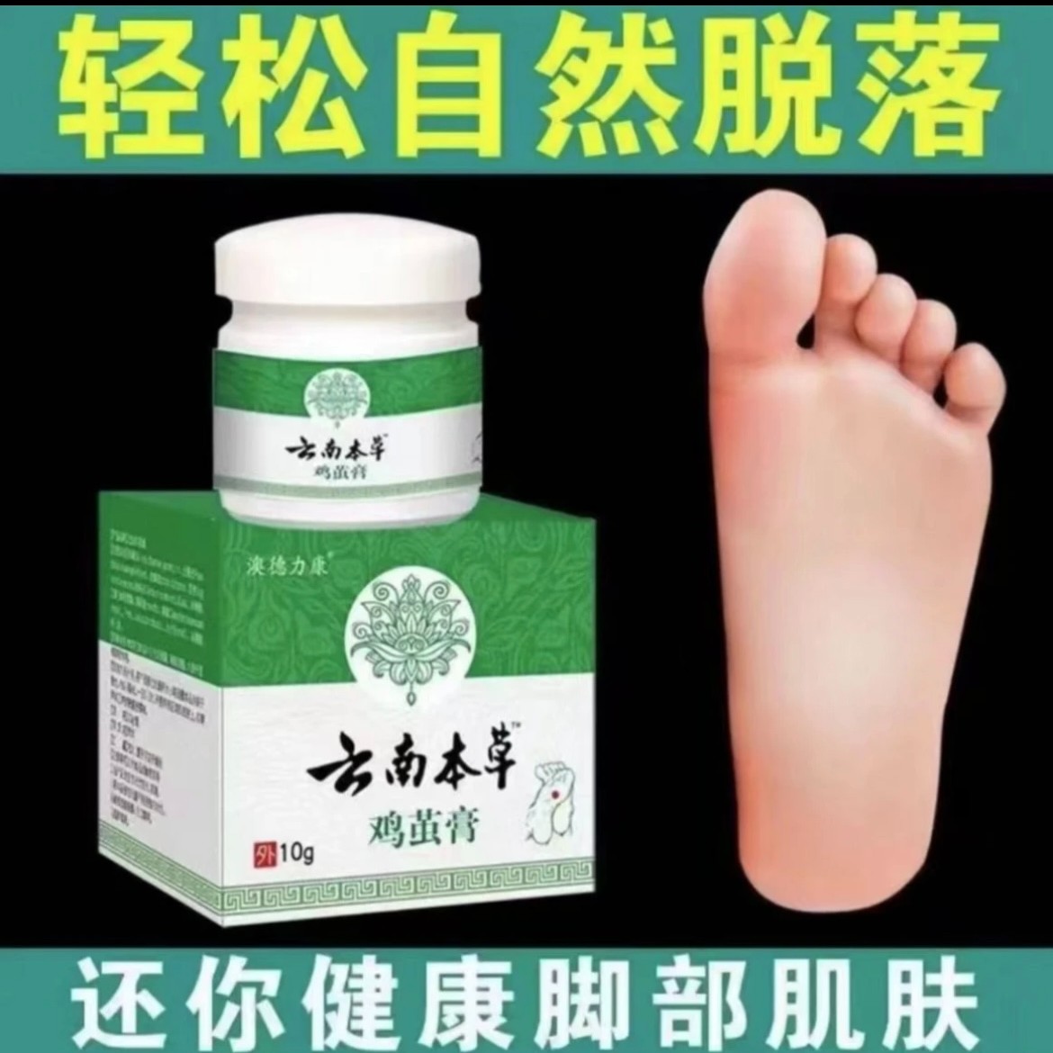 [买2送1]云南本草无痛鸡茧膏茧肉刺老茧硬手茧软化膏足裂修复膏
