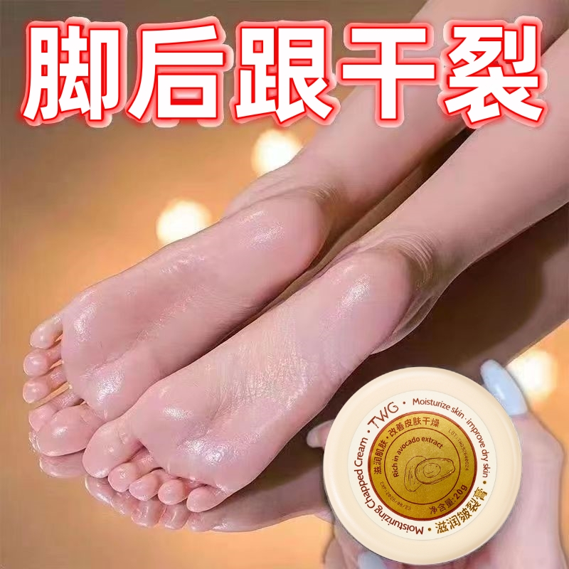 TWG脚后跟干裂起硬皮皲裂膏保湿霜防干裂防冻手足粗糙润足皴裂膏