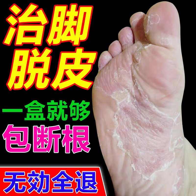 脚掌脱皮脚底脚心掉皮脱皮专用膏脚皮肤粗糙干燥干裂去除老茧软膏