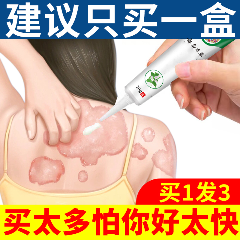 天然植物萃取温和呵护干痒止痒草本乳膏护手霜止痒快克皮肤抑菌膏