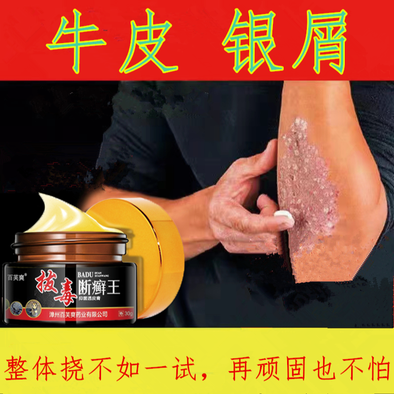 四季通用皮肤干燥瘙痒抑菌止痒牛皮/银屑乳膏涂抹快速同款有效