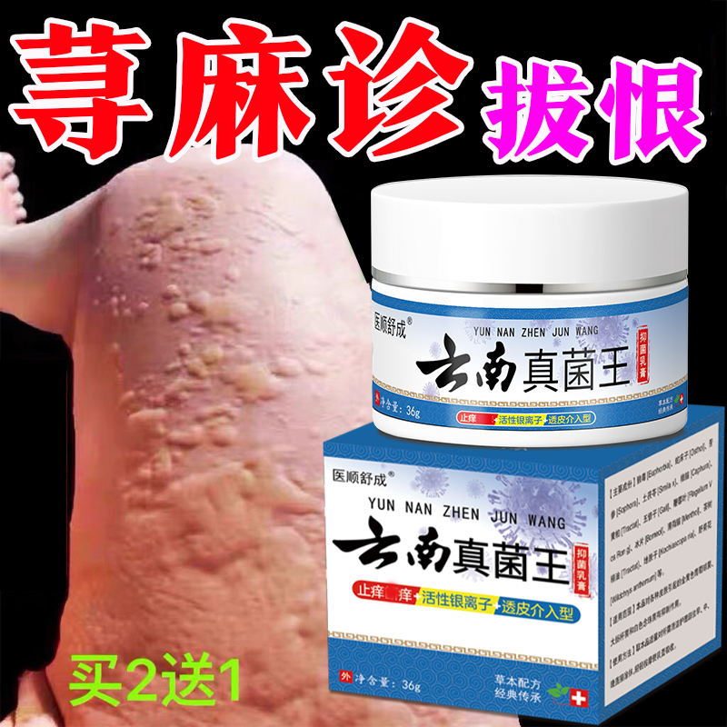 多年顽固荨麻越抓越痒块状条状快速止痒消肿抑菌软膏