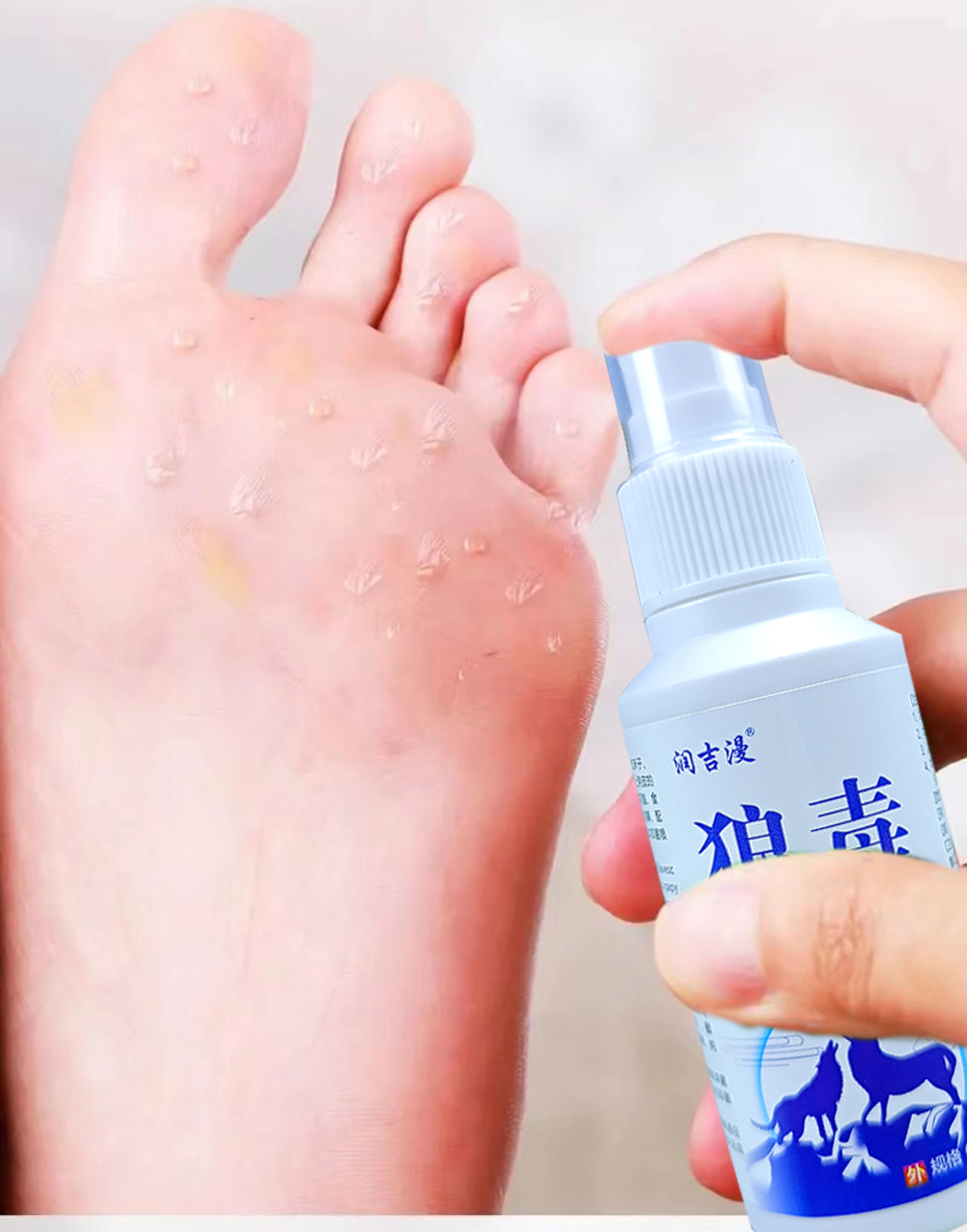 润吉漫狼毒喷雾60毫升