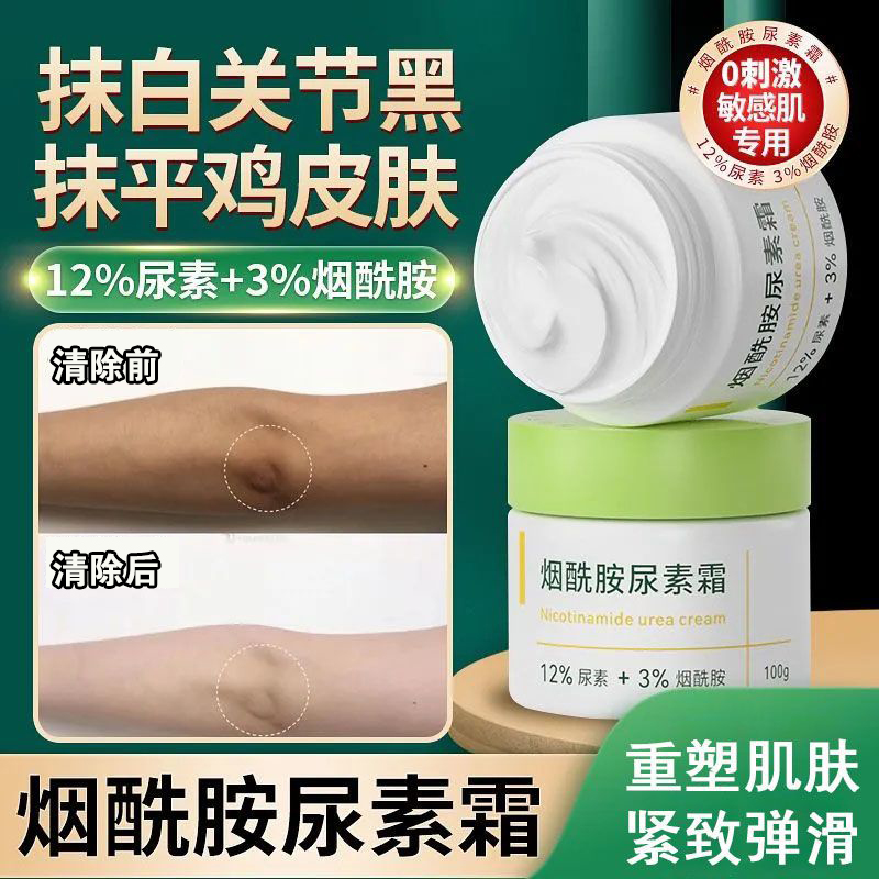 鹤叔推荐鸡皮肤尿素霜维生素e乳老国货补水保湿去鸡皮正品身体乳