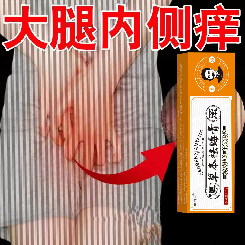 大腿内侧痒去潮湿男士大腿内侧出汗痒大腿内侧止痒膏下体痒