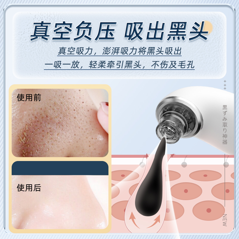小气泡吸黑头仪家用美容仪脸部去黑头粉刺神器吸出器毛孔清洁仪器