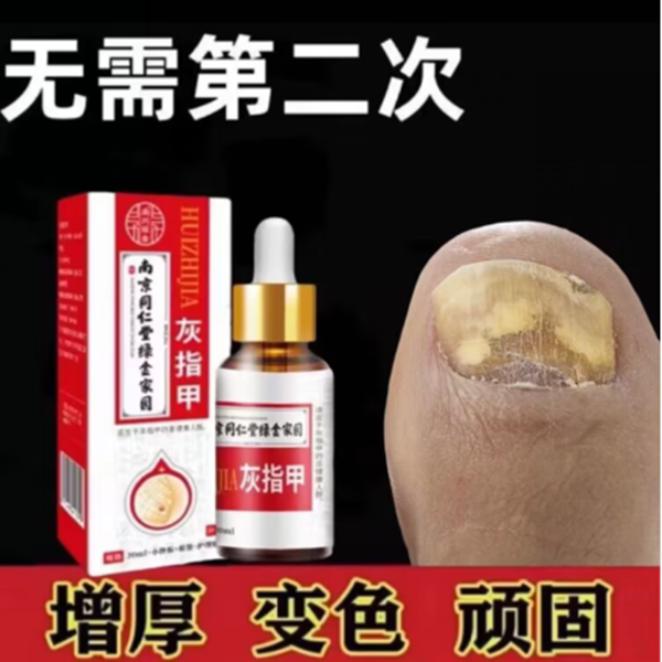 南京同仁堂草本灰趾指甲正品亮甲风仙花抑菌液增厚指甲修护脚指甲