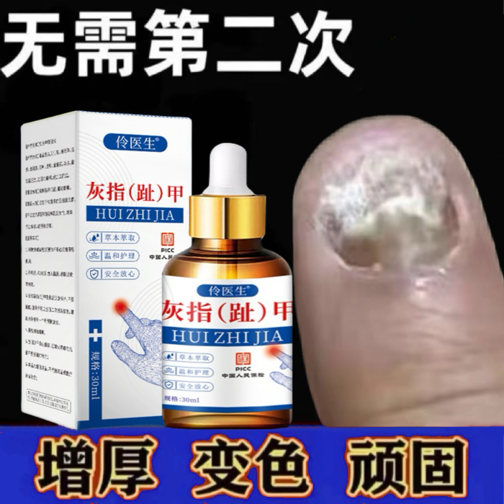 草本灰指甲专用特效药正品根治特效专用抑菌液亮甲灰指甲修护增厚