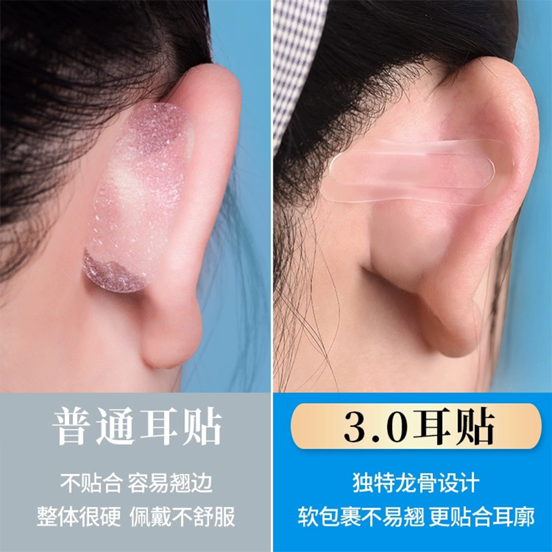3.0新升级精灵耳贴龙骨强支撑隐形立耳贴显脸小提拉神器防汗美颜